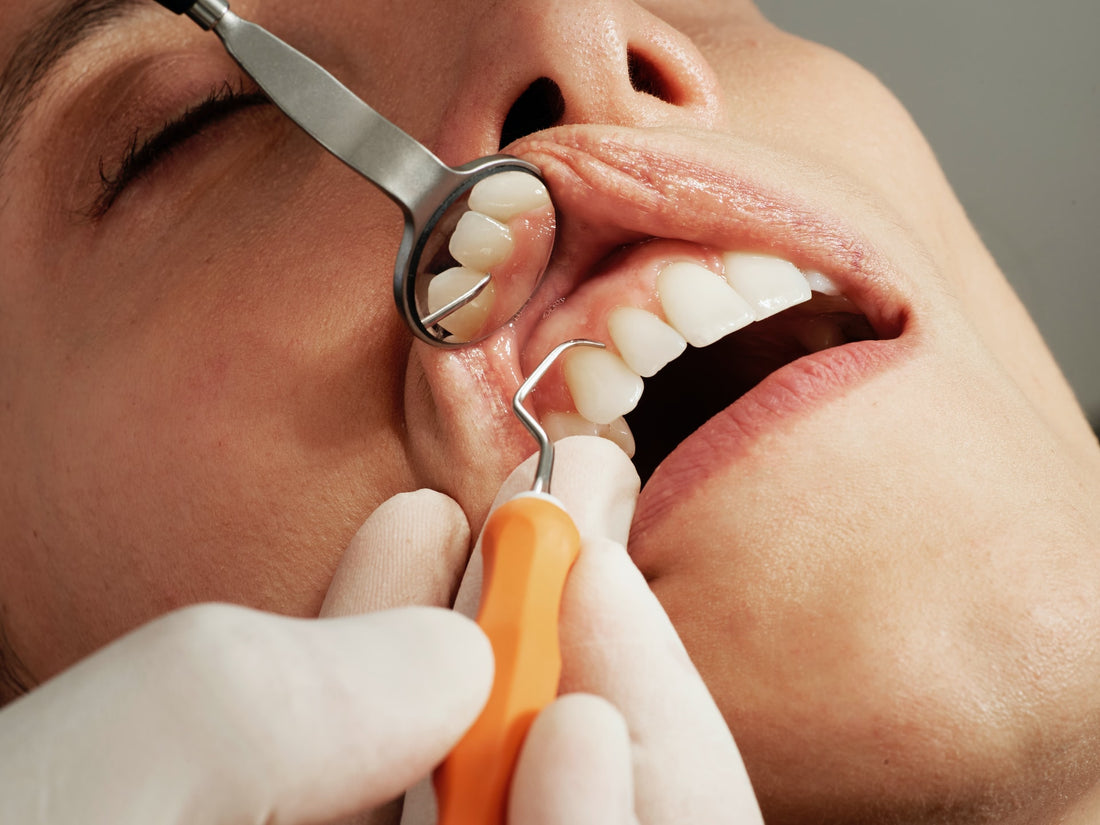 CBD for tooth pain